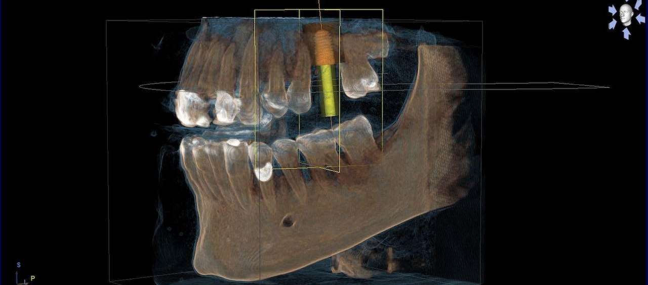 CBCT | Dentist
