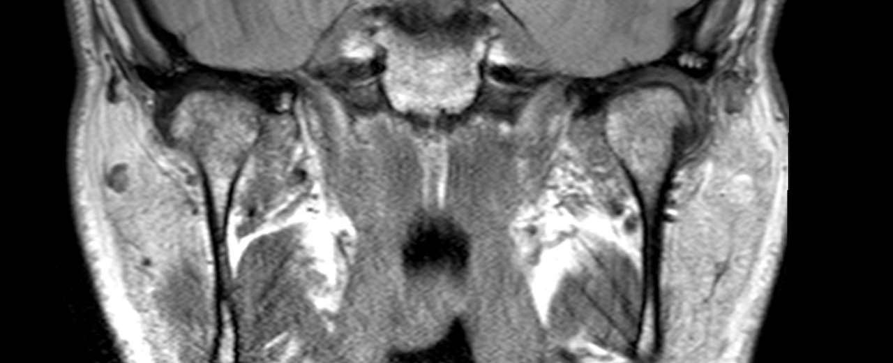MRI | Dentist