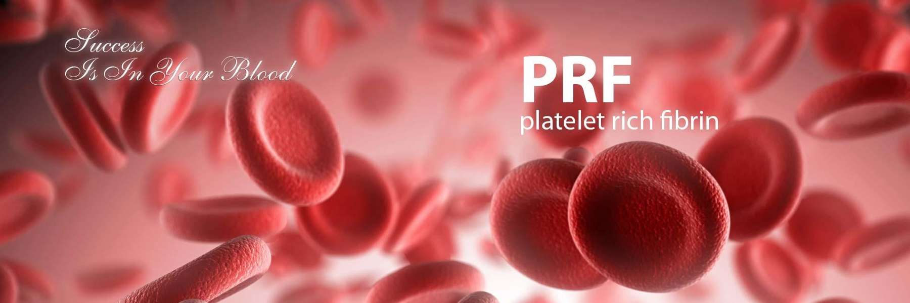 PRF (Platelet Rich Fibrin) | Dentist