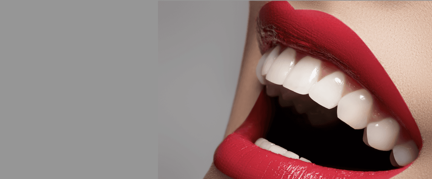 Whitening Teeth | Dentist