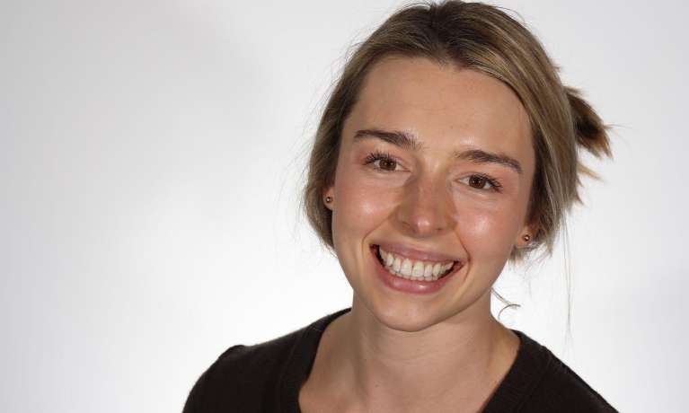 Suresmile-Orthodontic-Aligner-After-Image