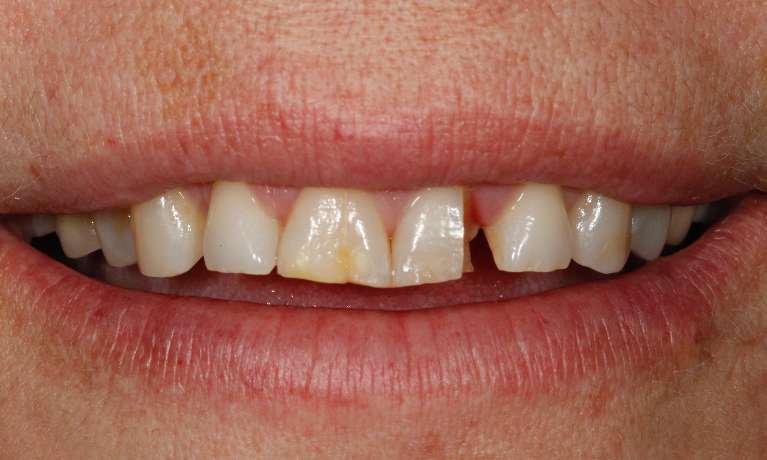 Laser-Composites-Before-Image